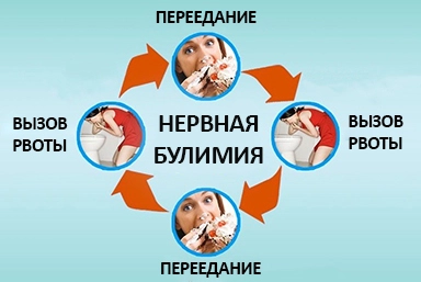 Лечение булимии в Мирном